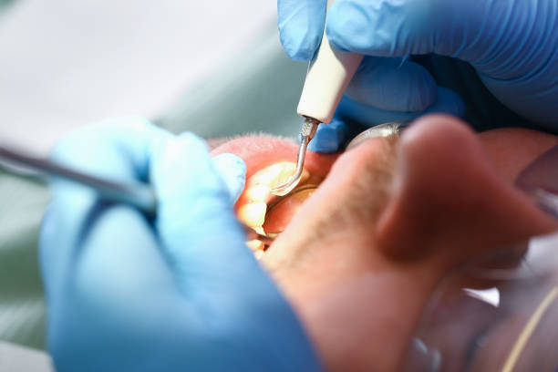 Best Emergency Treatment for Oral Infections in Atwater, MN